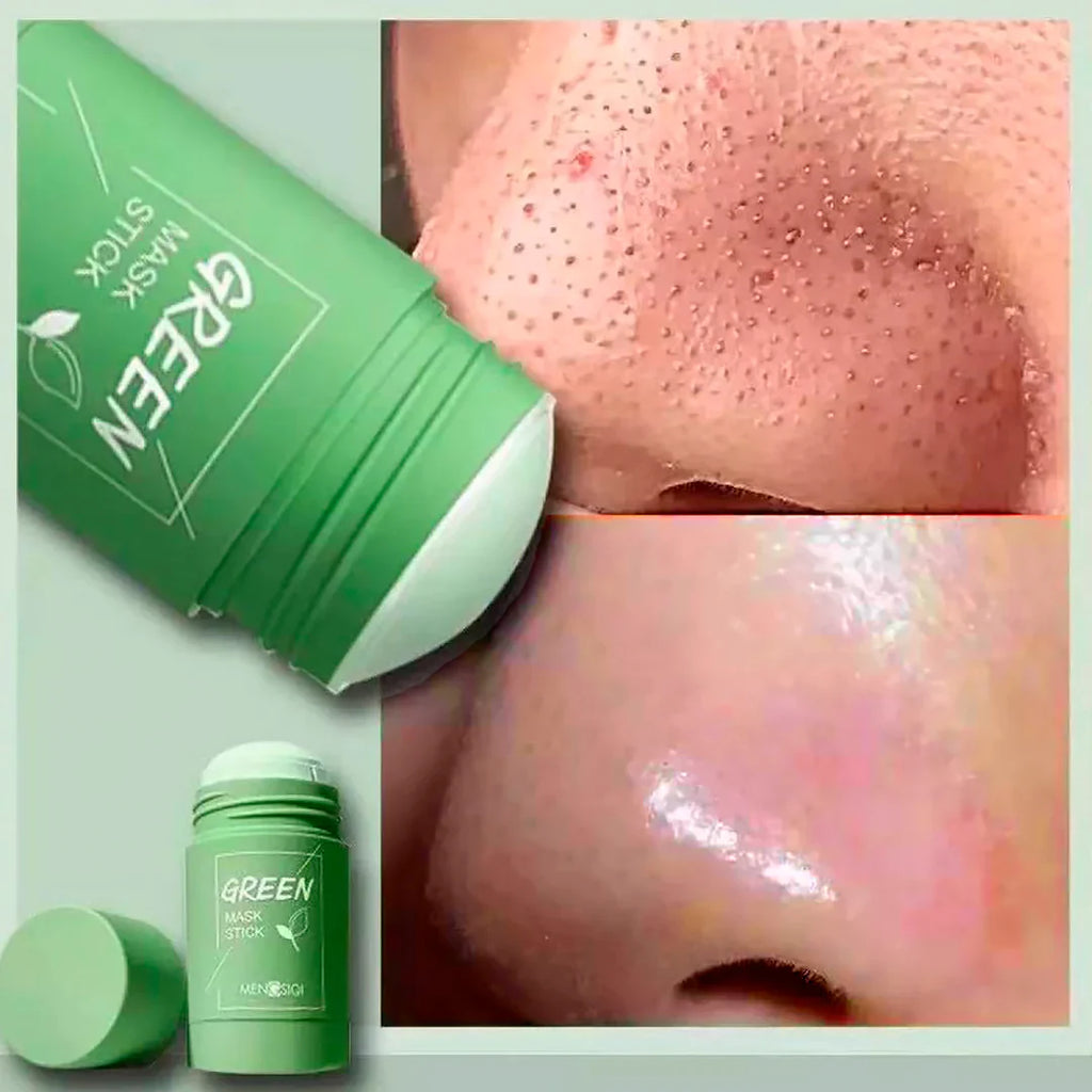 💚 Green Mask Stick – Limpieza profunda y eliminación de puntos negros